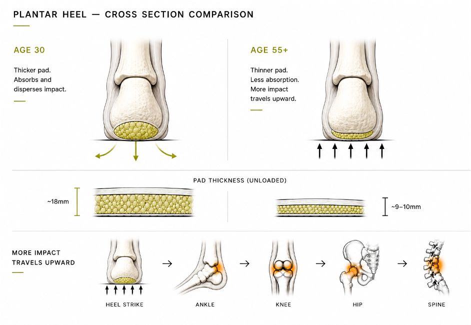 01.  Plantar Fat Pad