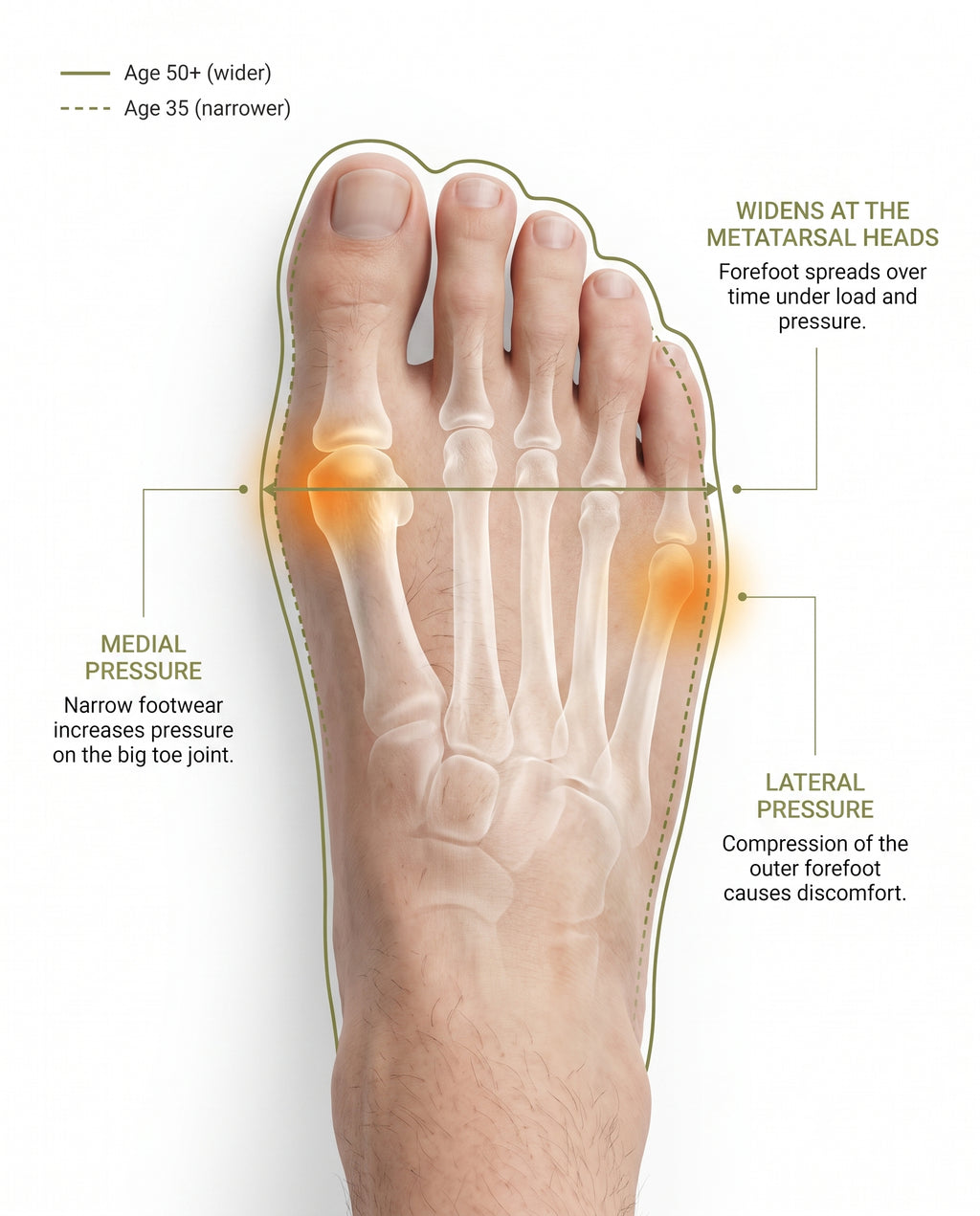 The foot you had at 35 is not this foot.